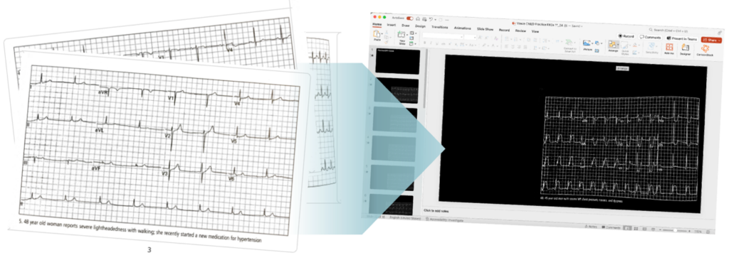 Displays original EKG images provided and the presentation after the colors were inverted for use in the lightroom.